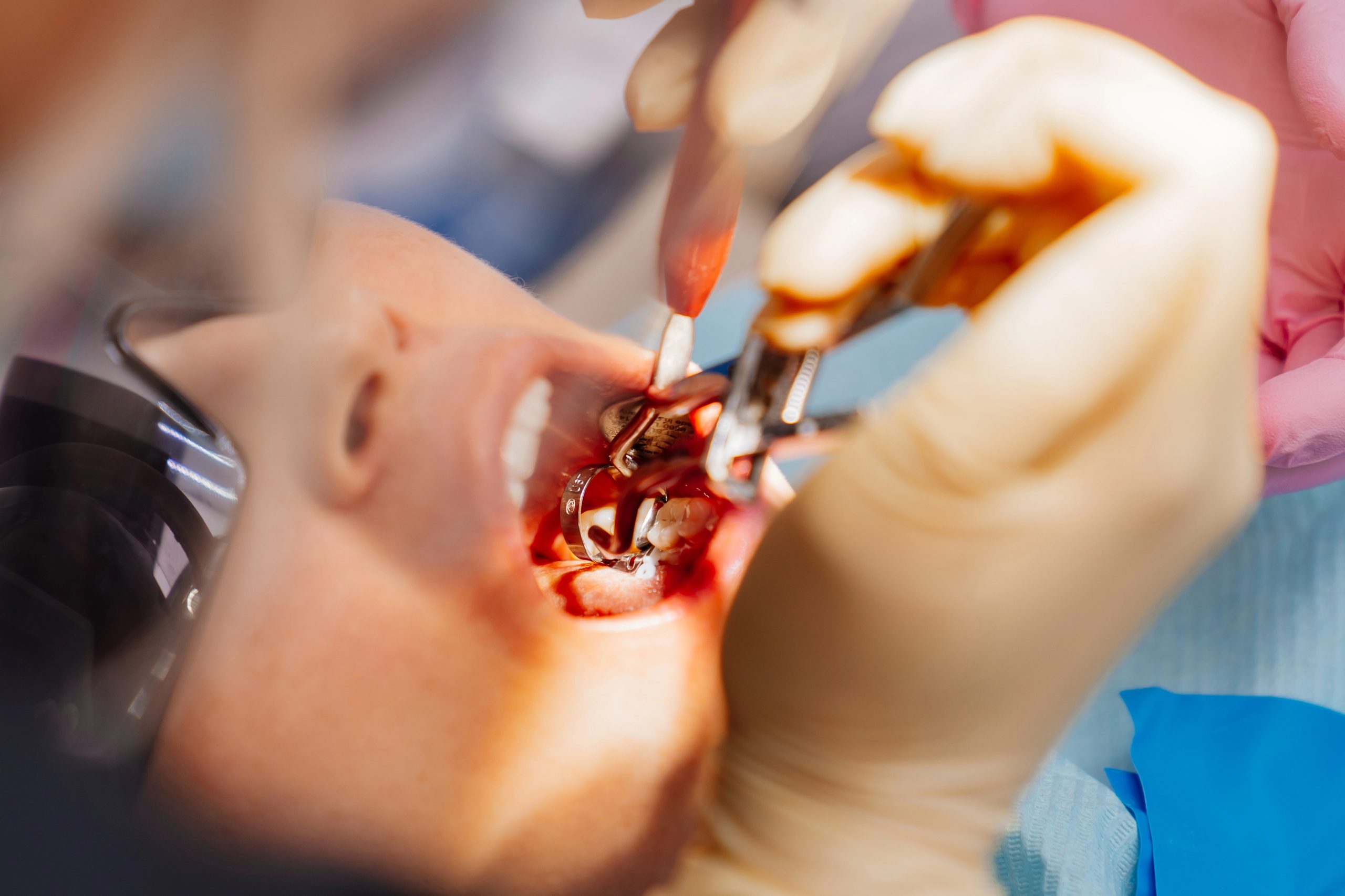 How Often Should Your Family Really Be Getting Professional Dental Cleanings in Mundelein?